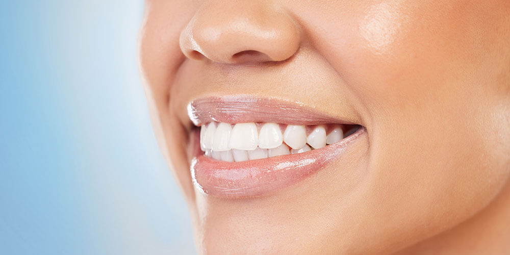 Fluoride Treatment Gatineau