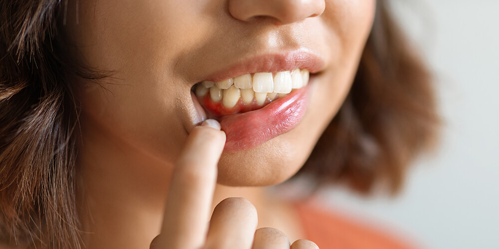 Periodontal Therapy Gatineau